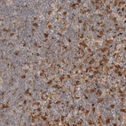 Anti-FAM167A Antibody