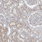 Anti-STC1 Antibody