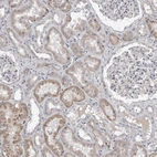 Immunohistochemical staining of human kidney shows weak to moderate cytoplasmic positivity in cells in tubules.