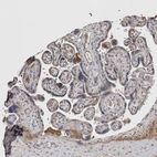 Immunohistochemical staining of human placenta shows weak to moderate cytoplasmic positivity in trophoblastic cells.