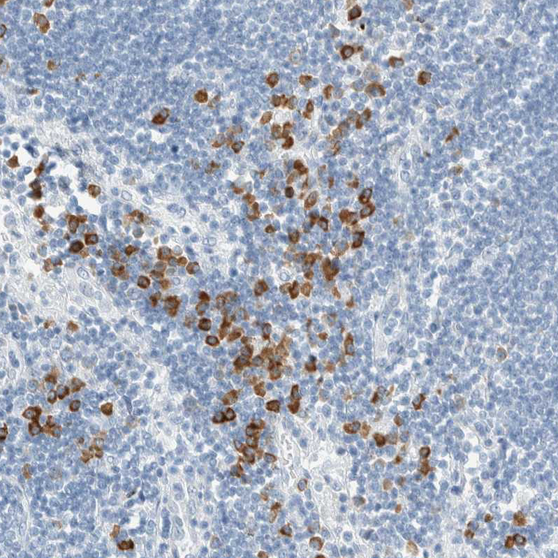 Anti-ARHGAP27 Antibody