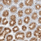 Immunohistochemical staining of human stomach shows strong cytoplasmic positivity in glandular cells.
