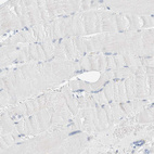 Immunohistochemical staining of human skeletal muscle shows no positivity in myocytes as expected.