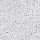 Immunohistochemical staining of human liver shows no positivity in hepatocytes as expected.