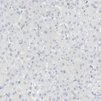 Immunohistochemical staining of human liver shows no positivity in hepatocytes as expected.