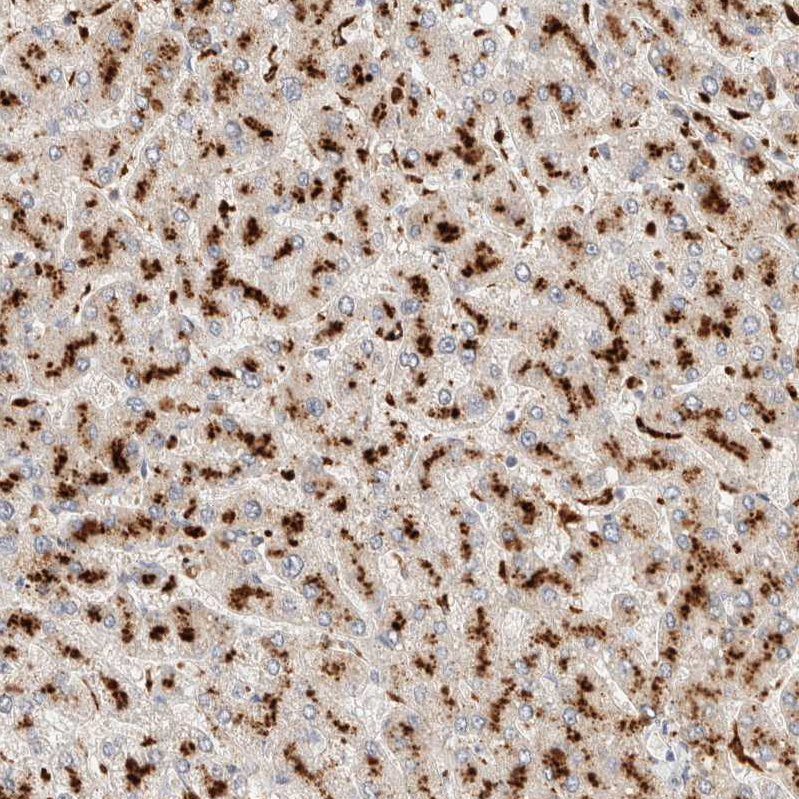 Anti-RABEPK Antibody