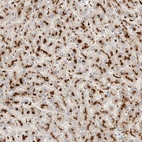 Anti-RABEPK Antibody