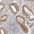 Immunohistochemical staining of human endometrium shows strong cytoplasmic granular positivity in glandular cells.