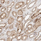 Immunohistochemical staining of human kidney shows strong cytoplasmic granular positivity in cells in tubules.