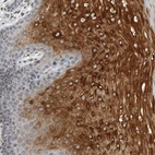 Immunohistochemical staining of human cervix, uterine shows strong cytoplasmic positivity in squamous epithelial cells.