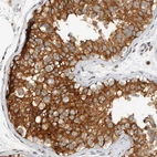 Immunohistochemical staining of human testis shows strong granular cytoplasmic positivity in cells in seminiferous ducts.