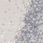 Immunohistochemical staining of human cerebellum shows no positivity in Purkinje cells as expected.