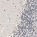 Immunohistochemical staining of human cerebellum shows no positivity in Purkinje cells as expected.