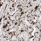 Anti-ZNF703 Antibody