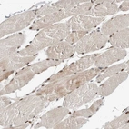 Immunohistochemical staining of human skeletal muscle shows moderate nuclear positivity in myocytes.
