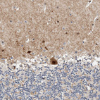 Immunohistochemical staining of human cerebellum shows strong nuclear positivity in Purkinje cells.