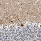Immunohistochemical staining of human cerebellum shows strong nuclear positivity in Purkinje cells.