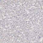 Immunohistochemical staining of human liver shows no positivity in hepatocytes as expected.