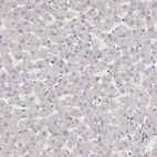 Immunohistochemical staining of human liver shows no positivity in hepatocytes as expected.