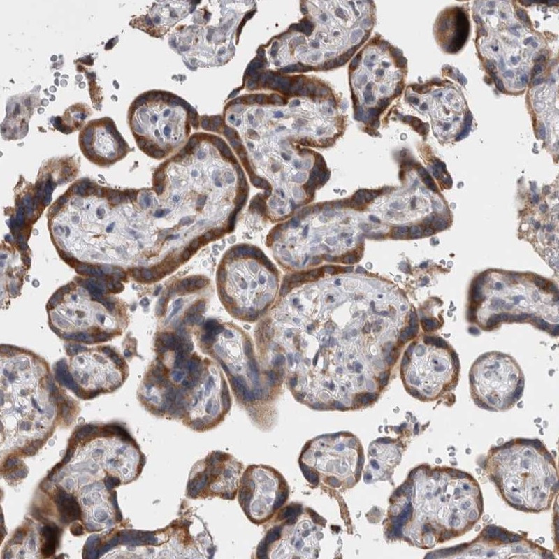 Anti-VCPIP1 Antibody