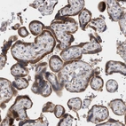Anti-VCPIP1 Antibody