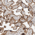 Anti-ZNF567 Antibody