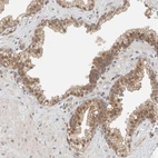 Immunohistochemical staining of human prostate shows weak nuclear and cytoplasmic positivity in glandular cells.