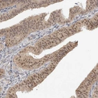Immunohistochemical staining of human fallopian tube shows weak nuclear and cytoplasmic positivity in glandular cells.
