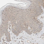 Immunohistochemical staining of human skin shows very weak positivity in squamous epithelial cells as expected.