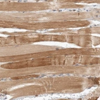 Immunohistochemical staining of human skeletal muscle shows strong cytoplasmic positivity in myocytes.