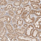 Immunohistochemical staining of human kidney shows moderate cytoplasmic positivity in cells in tubules.