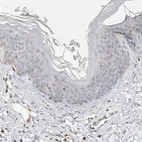 Immunohistochemical staining of human skin shows no positivity in squamous epithelial cells as expected.