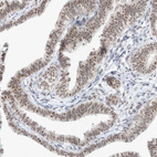 Anti-TRMT12 Antibody