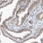 Anti-TRMT12 Antibody