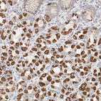 Anti-ATP6V1C1 Antibody