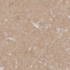 Immunohistochemical staining of human cerebral cortex shows moderate positivity in neuropil.