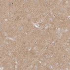 Immunohistochemical staining of human cerebral cortex shows moderate positivity in neuropil.
