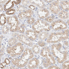 Anti-ATP6V1C1 Antibody