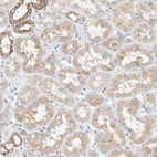 Immunohistochemical staining of human kidney shows moderate cytoplasmic positivity in cells in tubules.