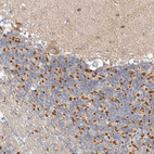 Anti-ATP6V1C1 Antibody