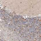 Immunohistochemical staining of human cerebellum shows strong cytoplasmic positivity in cells in granular layer.