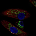 Immunofluorescent staining of human cell line RPTEC TERT1 shows localization to mitochondria.