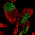 Immunofluorescent staining of human cell line RH-30 shows localization to nucleoplasm & nuclear membrane.
