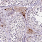 Anti-ZNF583 Antibody