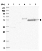 Lane 1: Marker [kDa] 230, 130, 95, 72, 56, 36, 28, 17, 11_br/_Lane 2: Human cell line RT-4_br/_Lane 3: Human cell line U-251MG sp_br/_Lane 4: Human plasma (IgG/HSA depleted)_br/_Lane 5: Human liver tissue_br/_Lane 6: Human tonsil tissue