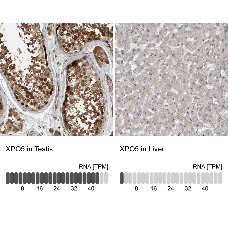 Anti-XPO5 Antibody