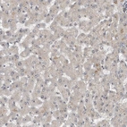 Immunohistochemical staining of human liver shows low expression as expected.