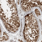 Immunohistochemical staining of human testis shows high expression.