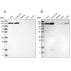 Western blot analysis using Anti-XPO5 antibody HPA023959 (A) shows similar pattern to independent antibody HPA018402 (B).