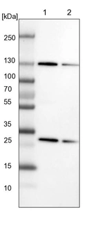 Lane 1: NIH-3T3 cell lysate (Mouse embryonic fibroblast cells)_br/_Lane 2: NBT-II cell lysate (Rat Wistar bladder tumour cells)